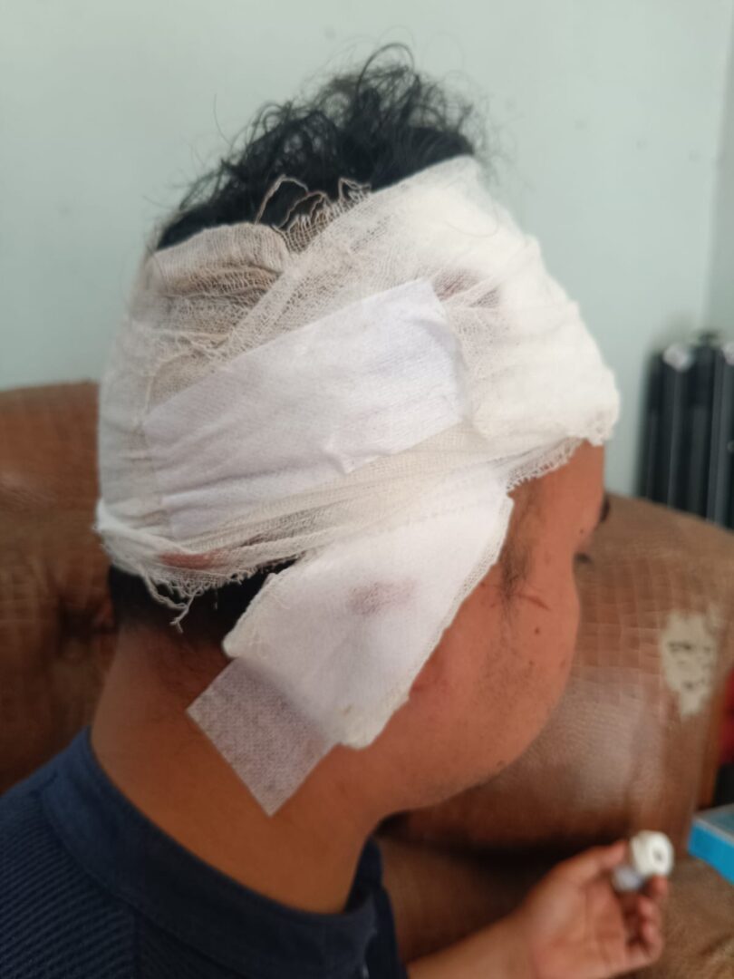 tagih-hutang,-pemuda-ibuah-dikeroyok-di-ompang-tanah-sirah,-kepala-robek-28-jahitan